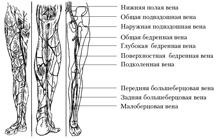 Варикозное расширение вен. Лечение традиционными и нетрадиционными методами