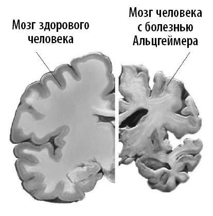 Ваш мозг. Что нейронаука знает о мозге и его причудах